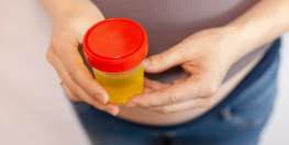 personne allant faire des analyses d'urine