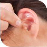 Un appareil médical posé sur une oreille