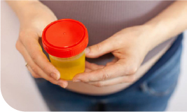 Une femme tenant un gobelet d'analyse d'urine